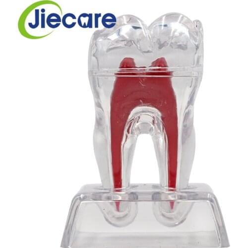 1PC Dental Crystal Base Hard Plastic Teeth Removable Tooth Molar Model Material Dentist Tools