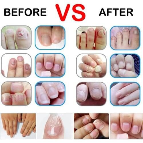 PEBELLIS Cuticle Oils