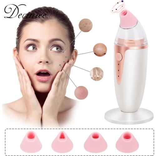 Professional Blackhead Remover Pore Vacuum Cleaner Acne Comedo Extractor USB Rechargeable Blackhead Tool with 4 Suction Tips