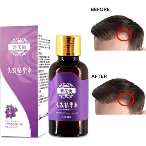 Средства от выпадения волос Disaar China At AliExpress