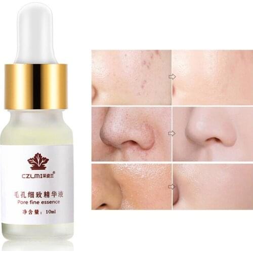 Сыворотки с кислотами для лица ROSOTENA China At AliExpress