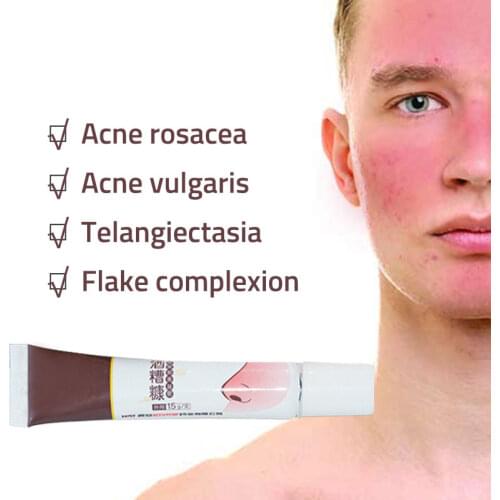 Herbal Anti Nose Mites Remove Acne Rosacea Cream Red Nose Blackhead Remover Acne Treatment Shrink Pores Face Bleaching Ointment