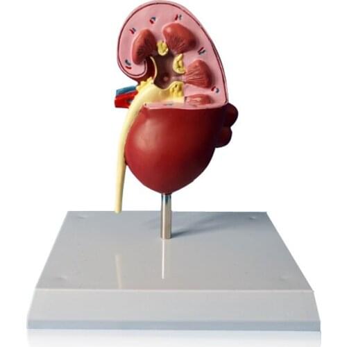 Dog Kidney Stone Renal Anatomical Model for Teaching Aids Veterinary Medical
