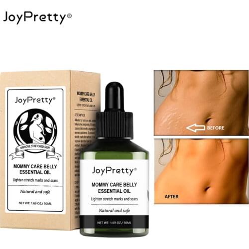 Joypretty Stretch Mark Oils China