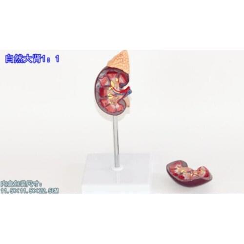 1:1 kidney anatomical model Adrenal gland model Human urinary system