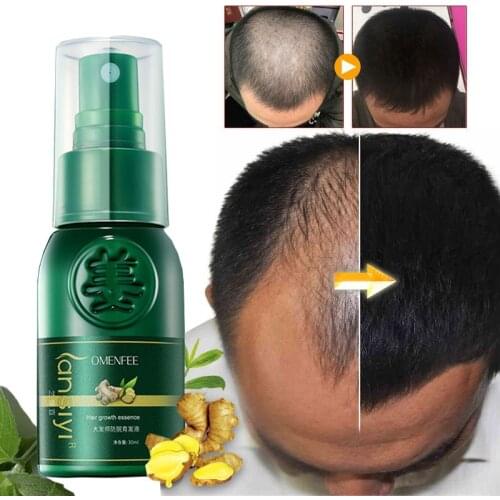 7 Days Ginger Hair Growth Products Man Woman Anti Hair Loss Treatment Fast Effective Germinal Repair Broken Dry Hair Spray Serum