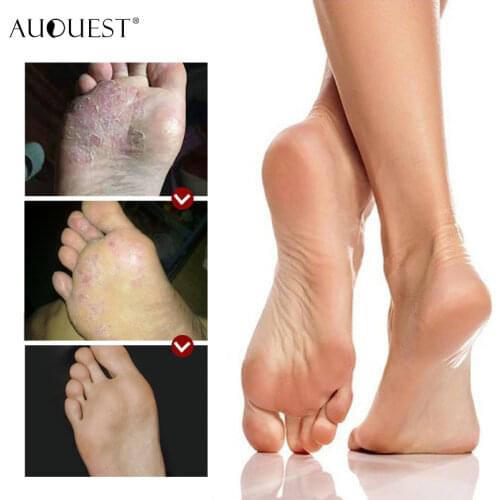 Joypretty Moisturizing Foot Masks
