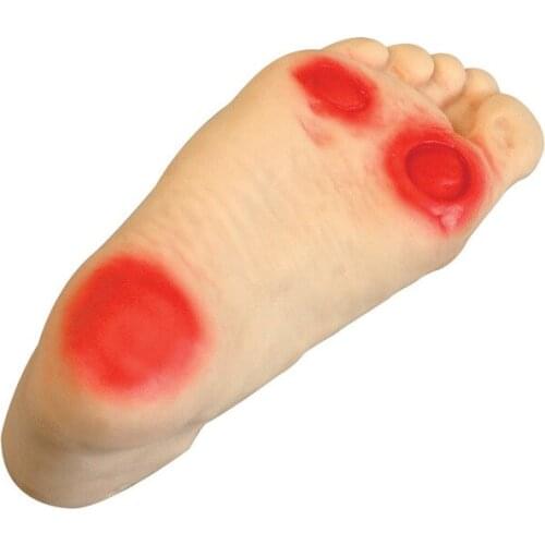 Foot nursing model Ill-conditioned foot nursing model