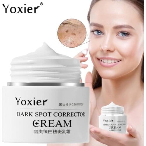 Dark Spot Correction Cream Remove Spots Anti-Aging Whitening Moisturizing Anti-Freckle Repair Spots Brightening Skin Care 30g