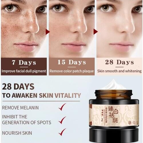 2021 New 30G Powerful whitening freckle cream Chinese herbal plant face cream remove freckle and dark spots Skin whitening cream