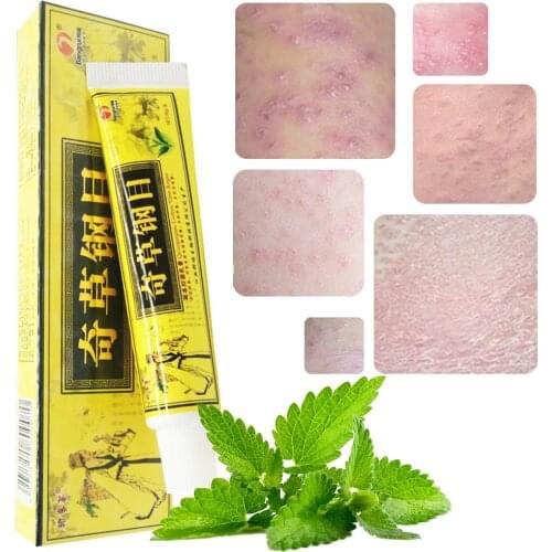 Advanced Body Psoriasis Cream For Dermatitis and Eczema Pruritus Natural Psoriasis scaly plaque Ointment Herbal Creams body care