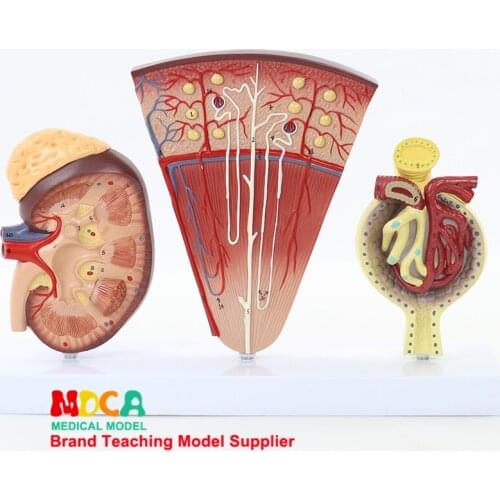 Medical teaching of urinary system MSZ007 for human glomerular enlargement model of nephron