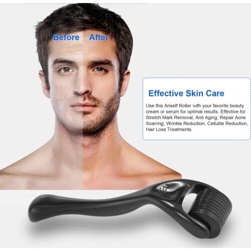 Massage Roller 540 Derma Roller 0.25mm Titanium Beard Roller for Hair Regrowth Beard Growth Anti-Hair Loss Skin Care Treatment