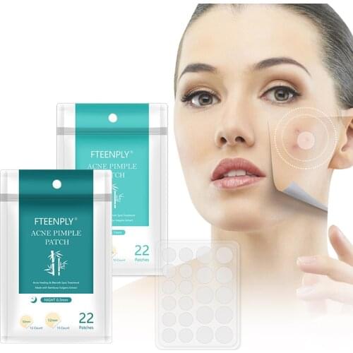 Acne Remover Treatment Cream Blackhead Remover Mask Acne Remover Tool Black Pimple Scar Skin Tag Removal Acne Patch