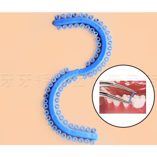 Good Quality 2016 NEW 10*Dental Orthodontic S Rings Ligature Elastics Ties Rubber Band
