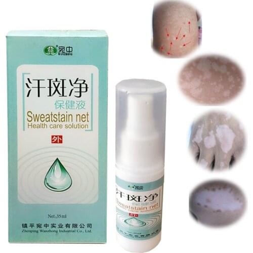 Chinese Herbal Medicine Spray Professional Treatment For Skin White Spot Vitiligo Eczema Sweatstain Net health Care Solution