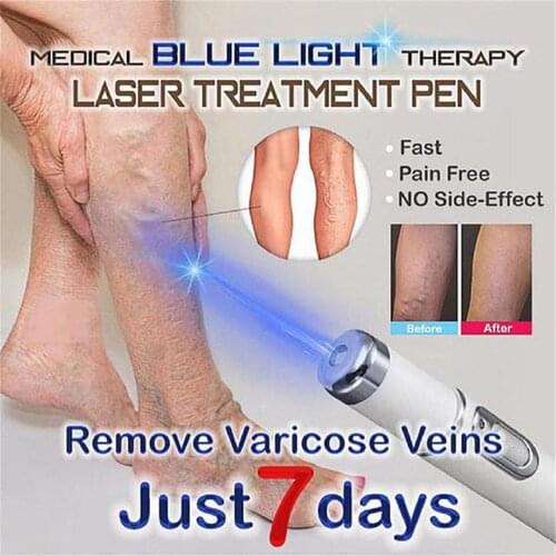 CAMMUO Cream For Varicose Veins