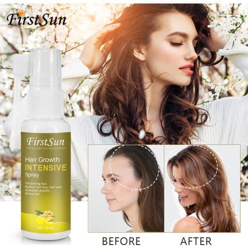 30ml New Hair Growth Spray Fast Ginger Essence Oil Hair Loss Treatment Preventing Hair Lost Alopecia Cure Care Serum