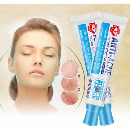 AcneClear Blemish Removal Cream Acne Cream