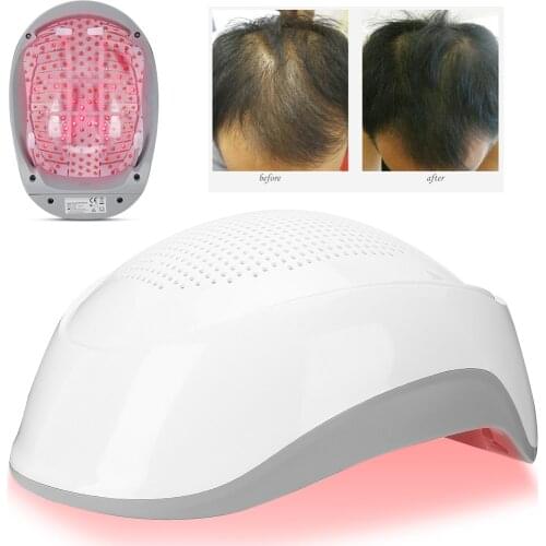 Laser Infrared Light Helmet Hair Growth Device 180pcs Light Chips Hair Regrowth Regrow Promoter Hat Anti Hair Loss Treatment Cap