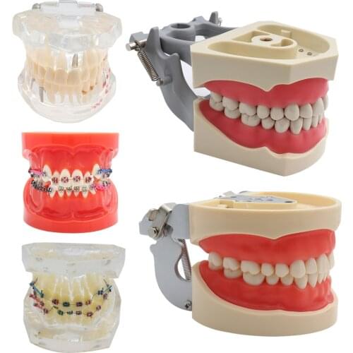 Dental Standard Teeth Model Orthodontic Teeth Model with Brackets & Buccal Tubes & Ligature Wire Implant and Restoration Model