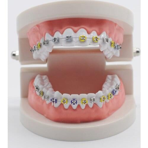 Orthodontic Model Ortho Metal Bracket Arch Wire Ligature Tie For Dental Study