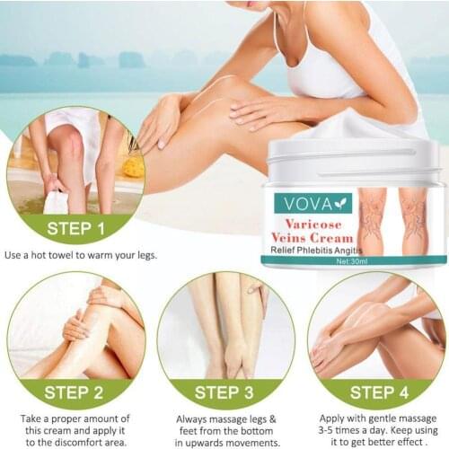 Varicose Veins Ointment Effective Treatment Vasculitis Medical Treatment Spider Plaster Herbal Leg Health Cream Fast Natural