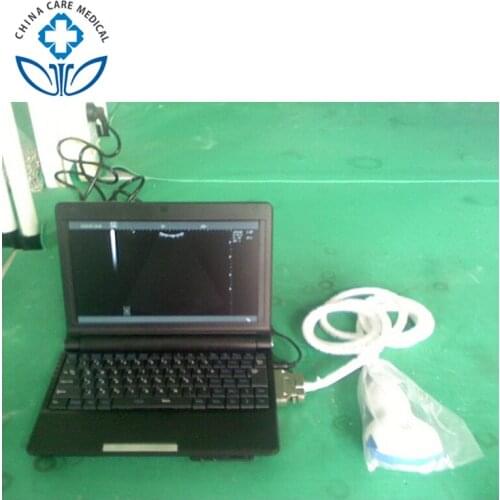 Digital Laptop Ultrasound Scanner