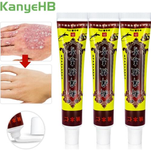 3pcs Remove Odor Antibacterial Cream Pussy Underarm Armpit Intimate Deodorant Pruritus Dermatitis Herbal Anti-itch Ointment A254