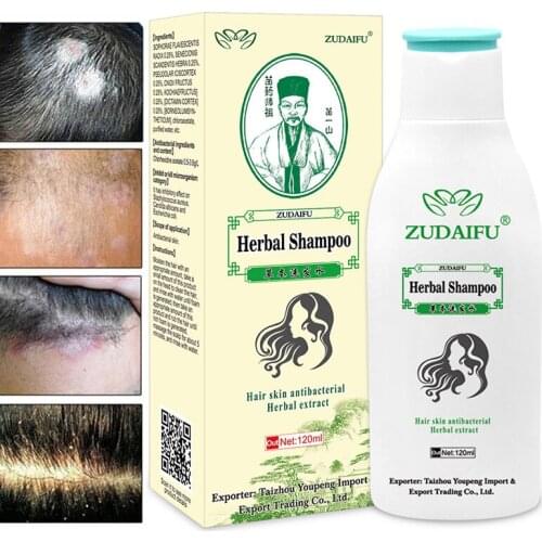 120ML Zudaifu Hair Psoriasis Seborrheic Shampoo Profissional Skin Care Treatment Dermatitis Eczema Compound Herbal Antibacterial