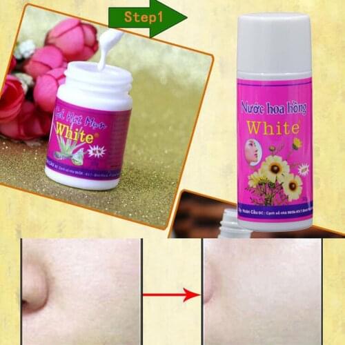 White Aloe Peel Cleanse Face Nose Strips to Remove Blackhead Shrink Pores Peel Off Mask Deep Cleansing Remover Gel