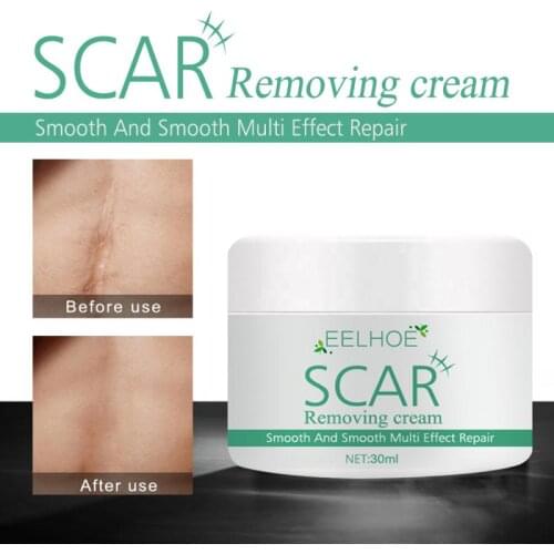 Scar Removal Cream Scald Burn Scars Old Scars Acne Marks Postoperative Scars Heal Skin Care Smoothing Repair Cream 30g TSLM1