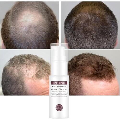 VIBRANTGLAMOUR Hair Growth Essence Essential Oil Liquid Spray Nourish Roots Thick Shiny Prevent Hair Loss Anti-Hair For Menwomen