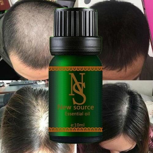 Ginger Hair Care Essential Oil Natural Grow Nutrient Solution Soft Moisturizing Germinal Hair Growth Serum Hairdressing 10ml