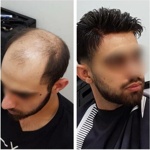 Men Hair pieces Remy Hair Handmade Replacement Systems Mens Toupee Mono PU Wave Topper Natural Color Indian Remy Hair