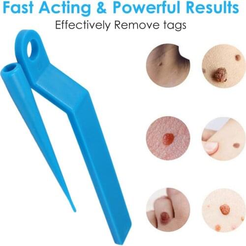 Skin Tag Remover Device For Small To Medium Skin Tags With Cleansing Swabs Adult Mole Wart Face Care