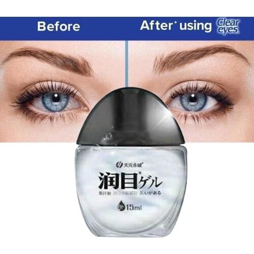 Cod Liver Oil Eye Drops Relieve Dry Eyes And Swelling Eye Drops Have The Effect Of Relieving Blurred Vision And Visual Fatigue