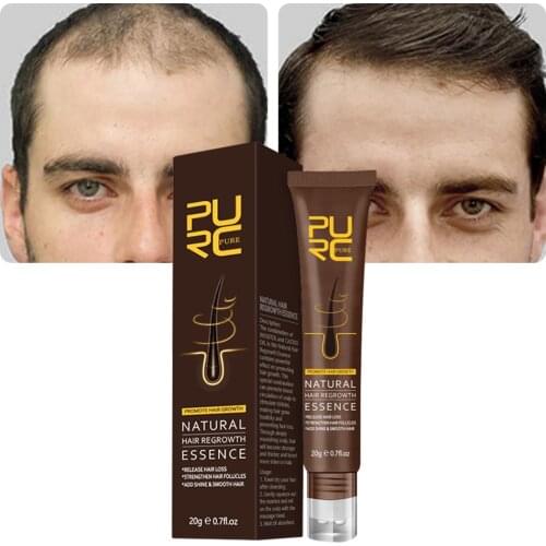 Hair Growth Essence Oil Prevent Hair Loss and Dryness Hair Scalp Massage Roller Promote Regrowth for Men Women