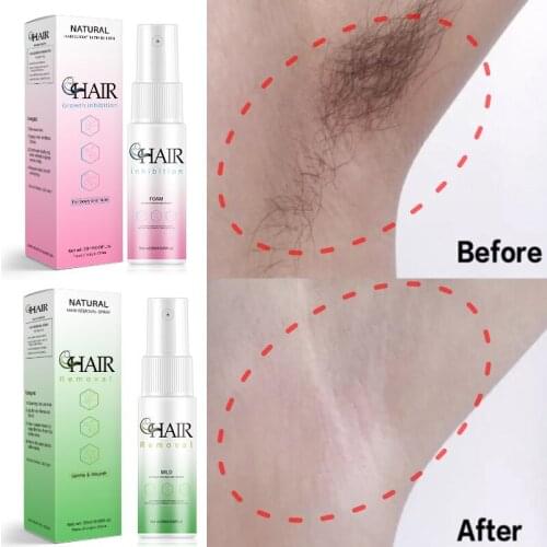 Permanent Hair Removal Inhibitor Spray Face Legs Body Armpit Painless Hair Stop Growth Spray