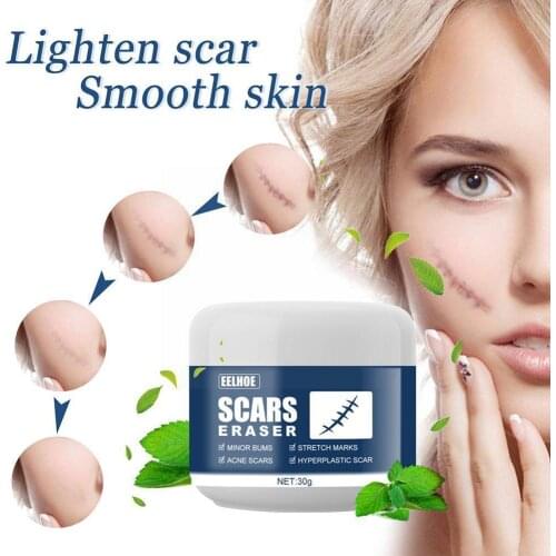 Scar cold compress gel Scar Removal Cream Acne Surgical Pigmentation Burn Stretch Scar Gel For Body Scars Corrector P6Y7