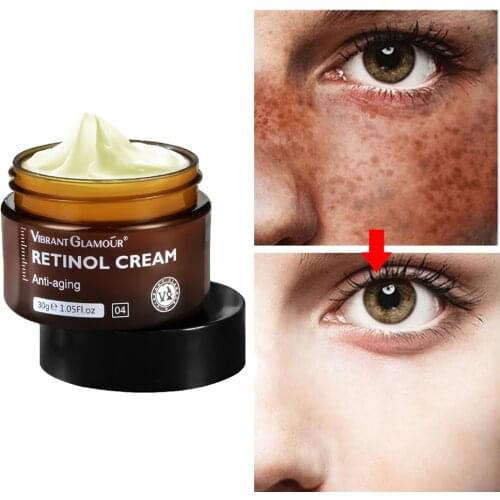 Effective whitening cream Retinol removes melasma acne spots pigment dark spots pigmentation moisturizing gel skin care