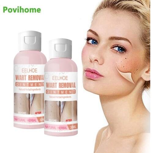 1Pcs 30ml Warts Removal Cream Remove Skin Tag Foot Corn Mole Sarcoma Ointment Skin Care Antibacterial Herbal Medical Plaster