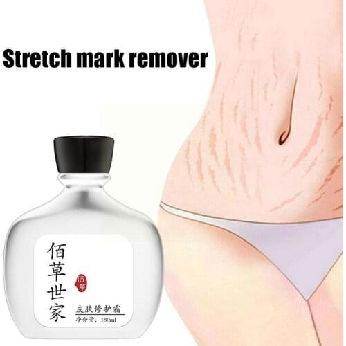 180ml Stretch Marks Removal Cream Pregnancy Repair Women Obesity Skin Care Cream Cream Body Postpartum M0U1
