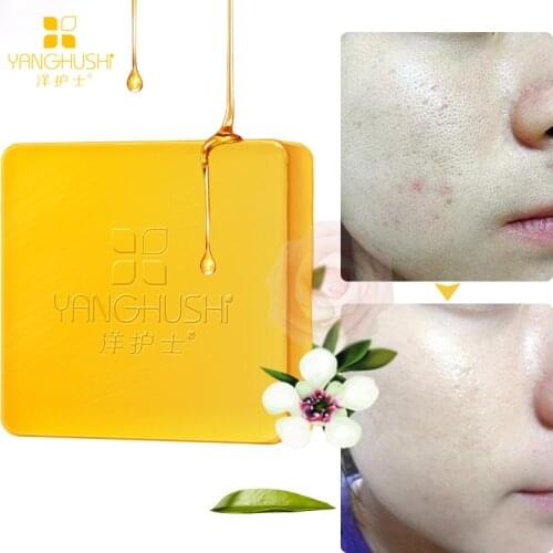 Antibacterial Propolis Bath Soap Cleans the Skin, Removes 99.9% of Bacteria Removes Mites Reduces Acne