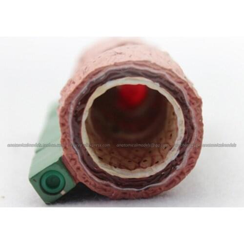 CMAM/12483 Heart-Arteriosclerosis, Human Heart Medical Teaching Anatomical Model