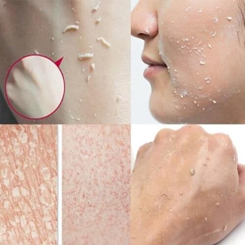 Exfoliating Face Scrub Peeling Gel Moisturizing Whitening Vitamin C Skin All Detoxifies And Cleanses Remove Acne Lemon P1M7