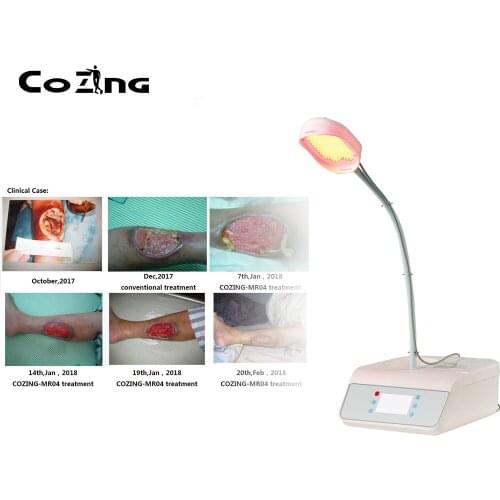 PDF Led Light Therapy LED Device Skin Rejuvenation Photon Device Spa Acne Remover Anti Wrinkle Light Treatment