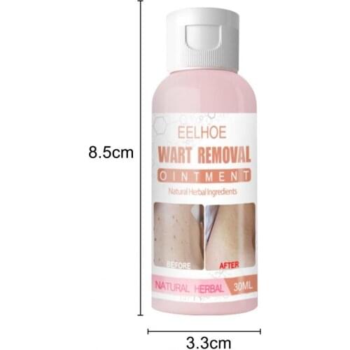 30ML Freckle Cream Freckle Gel Natural Non-irritating Herbal Ingredients Dark Spot Wart Removal Ointment Cream for Female