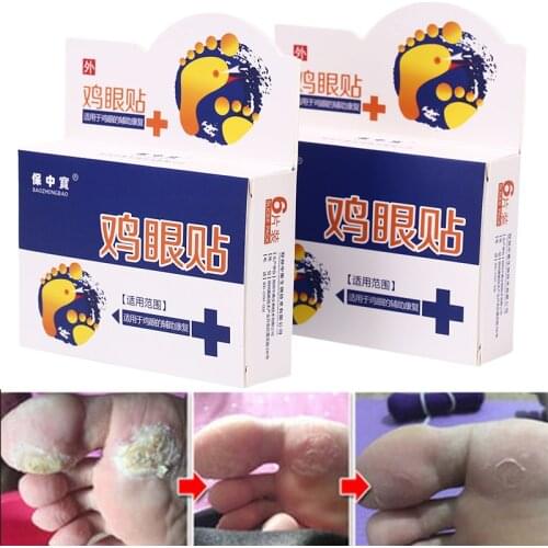 6pcs Foot Corn Patch Medical Plaster Foot Corn Removal Calluses Plantar Warts Thorn Plaster For Relieving Pain Health Care