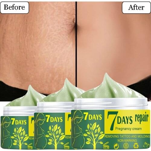 Removal Pregnancy Scars Cream Stretch Marks Treatment Maternity Body Repairing Moisturizing Firming Women Skin Care Cream